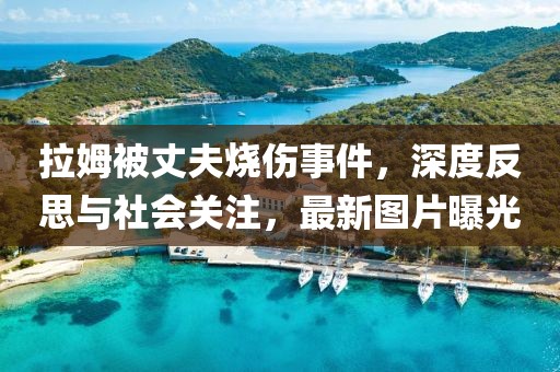 拉姆被丈夫烧伤事件，深度反思与社会关注，最新图片曝光