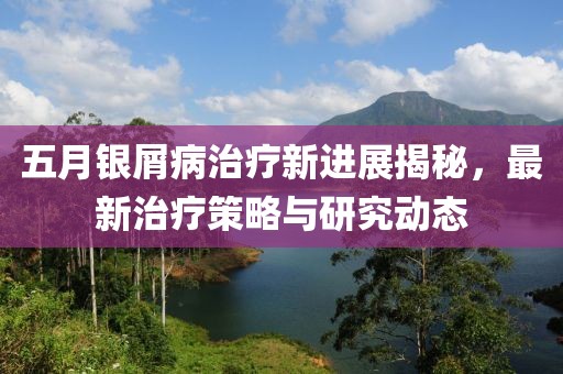 五月银屑病治疗新进展揭秘，最新治疗策略与研究动态